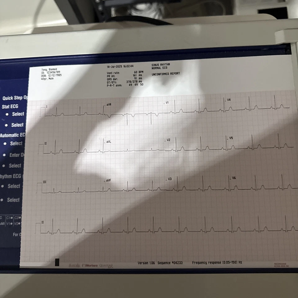Electrocardiógrafo Welch Allyn CP 10 ECG con cable LED. Foto 2 de 4