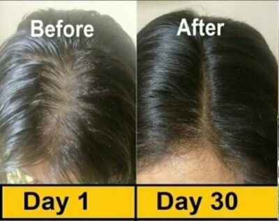 100 Caps EVION Vitamin E 200 mg Capsules For Face Hair Acne Nails Glowing skin