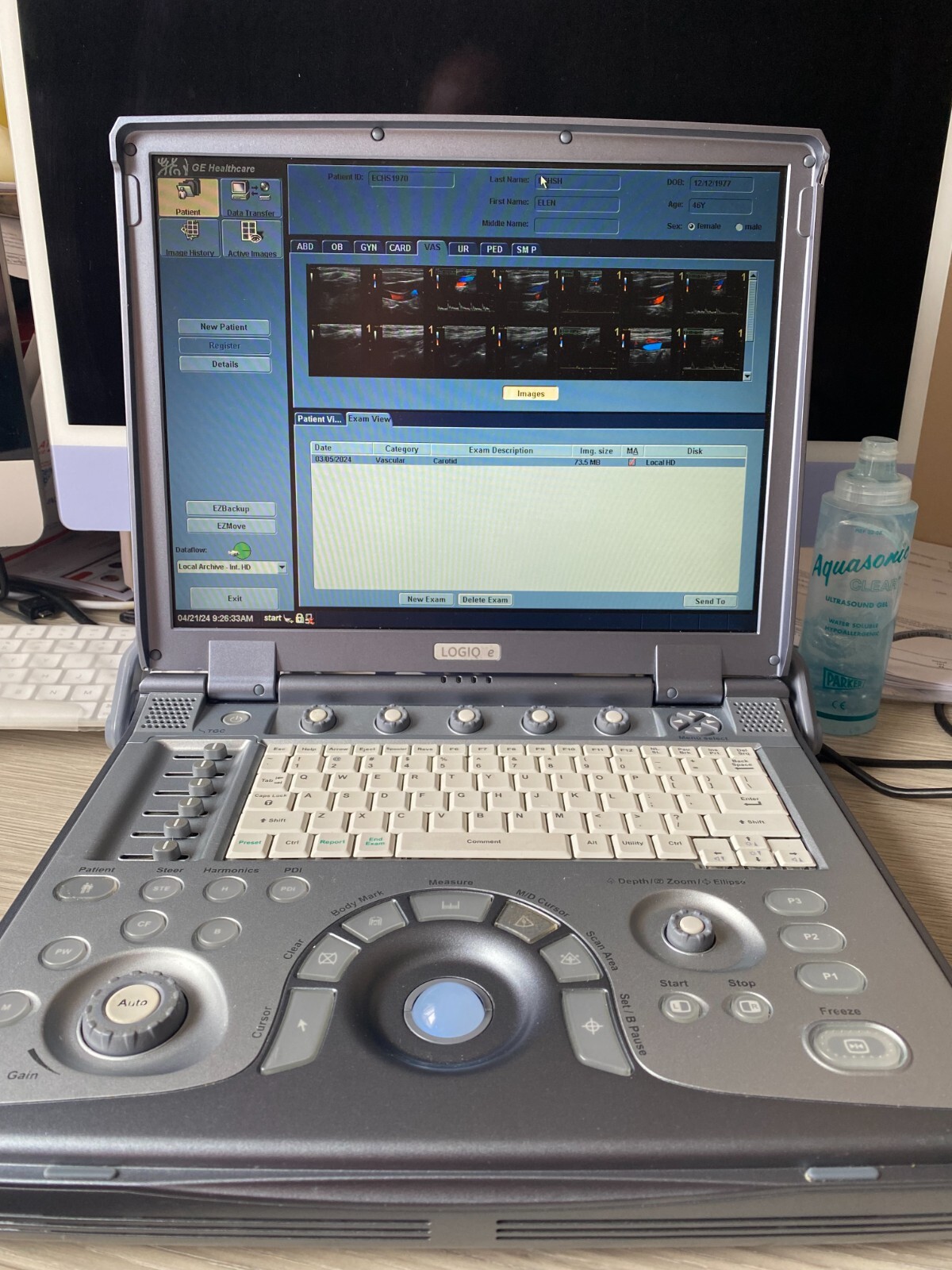 GE LOGIQ e Portable Ultrasound Machine . Working and looks great.