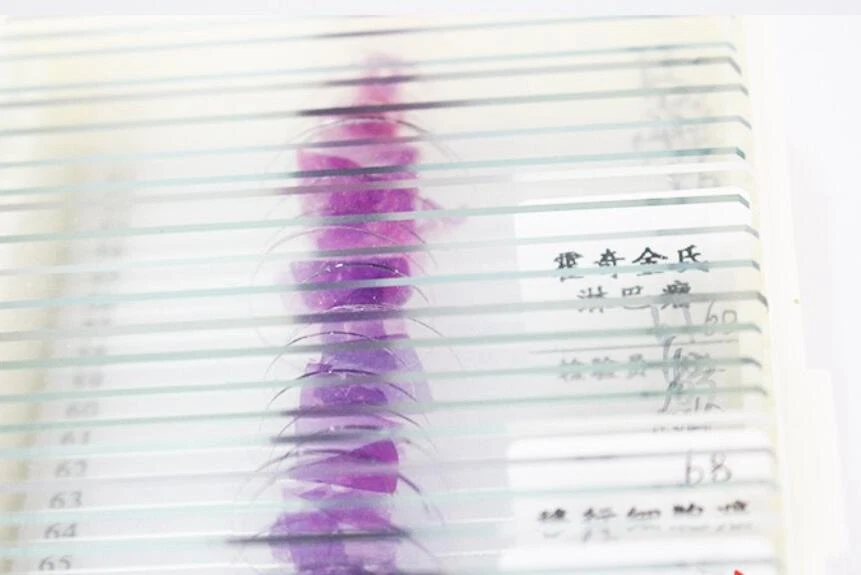 Conjunto de 100 piezas de diapositivas preparadas para microscopio de patología de mamíferos muestra Foto 3 de 4