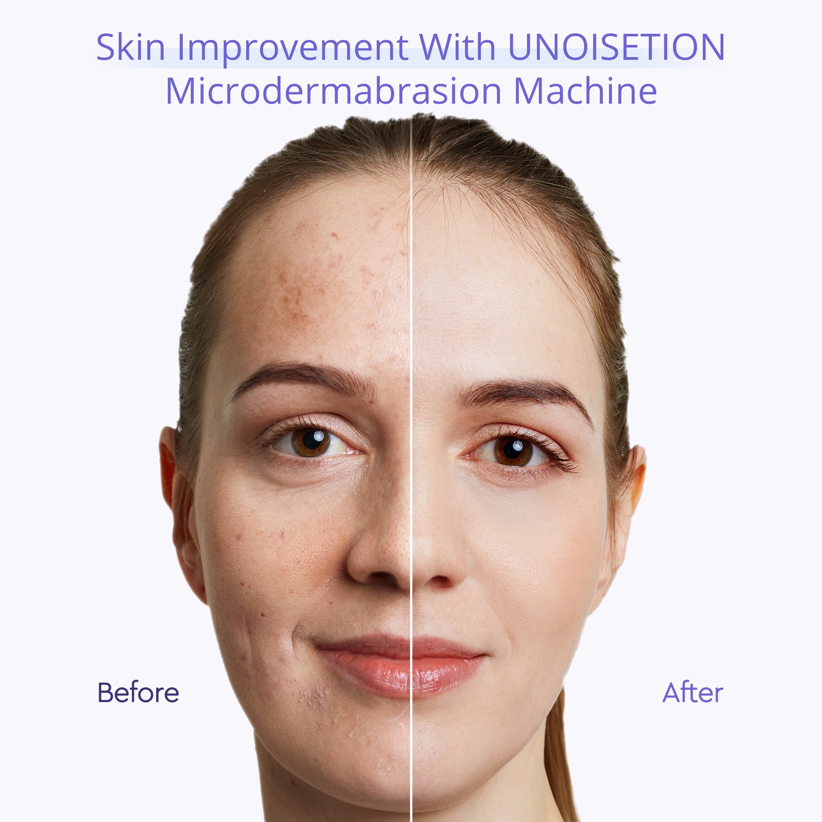 3in1 Diamond Microdermabrasion Dermabrasion Peel Vacuum Skin Care Facial Machine