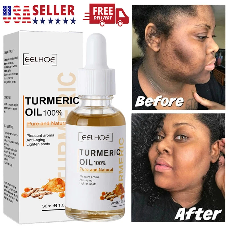 Turmeric oil clearance for face
