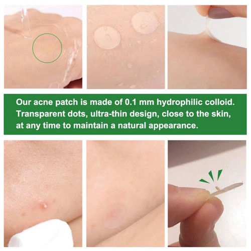 Patches Blemish Control Facial Spot AU Removal Acne Pimple Patch 24 Pcs Plasters - Picture 10 of 12