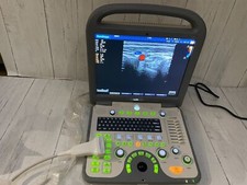 SonoScape S8 con transductor de sonda de matriz lineal L741