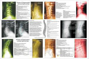 Chiropractic Posters And Charts