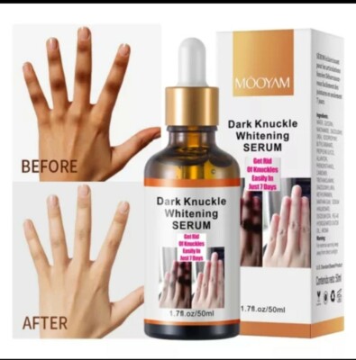 Dark Knuckle Serum Pigmentation Correctors Stain Remover