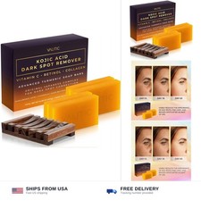 Valitic Kojic Acid Dark Spot Remover Soap Bar with Vitamin C, Retinol, Collag...
