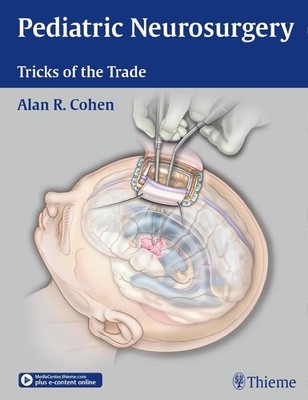 Pediatric Neurosurgery: Tricks of the Trade | Alan R Cohen | englisch