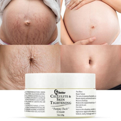 Stretch Marks and Scars Removal Cream for Pregnancy - Scars Repair, Abdominal Fi