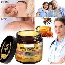 Bee Venom Skin Tag Removal Treatment Cream Body Care Mole Corn Wart Remover 2026
