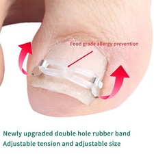 Ingrown Toe Nail Correction Lifter Tool Fixer Toenail Straightener Corrector