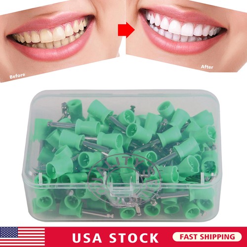 100Pcs Dental Rubber Prophy Teeth Polish Polishing Cups Latch Type Brushes USA - Picture 9 of 27