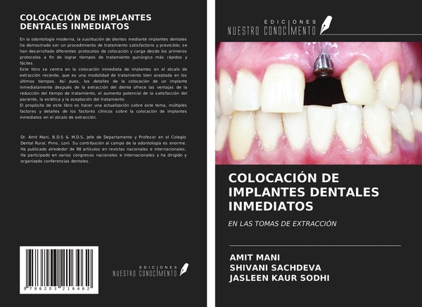 ColocaciÓN DE Implantes Dentales Inmediatos Amit Mani-image