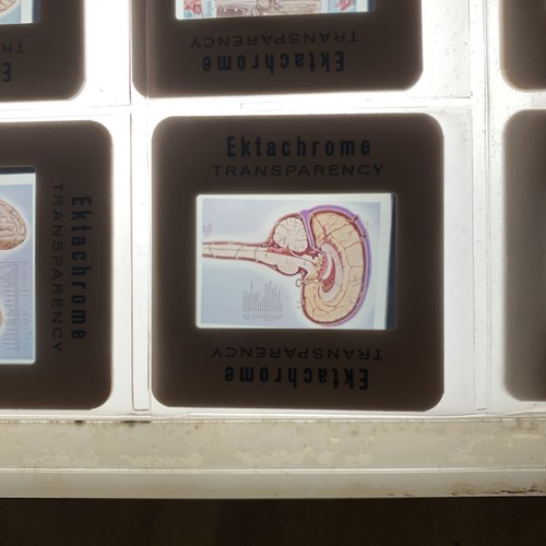 Vintage Medical Slides - Picture 17 of 19