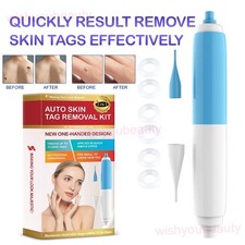 2 in 1 Micro Skin Tag Remover Pen Painless Warts Removal Kit Beauty Tool