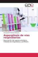 Aspergilosis De VíAs Respiratorias Irene Jaquelin Palacios VeláZquez