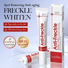 Freckle Cream Face Whitening Creams Spot Removing Anti-aging Skin Care 20g