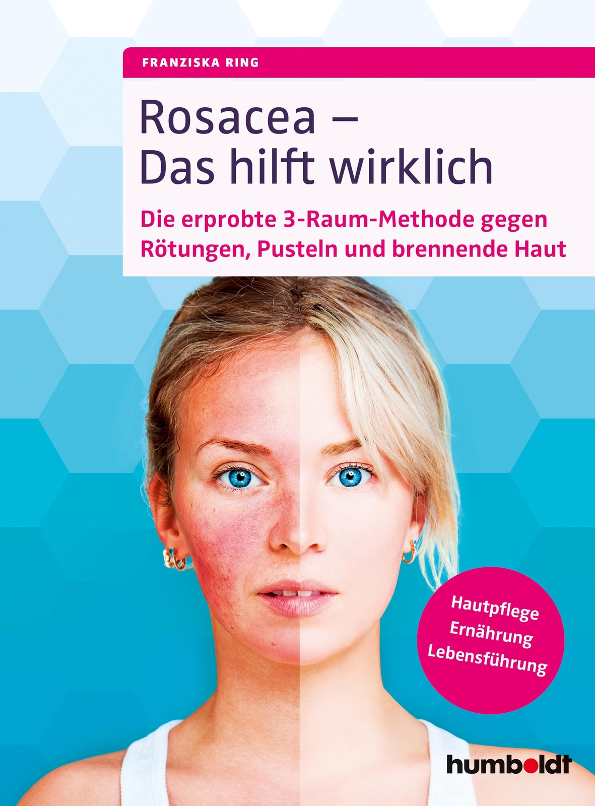 Thumbnail - Rosacea - Das Hilft Wirklich Franziska Ring Taschenbuch 160 S. Deutsch