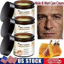 Bee Venom Skin Tag Removal Treatment Cream Body Care Mole Corn Wart Remover