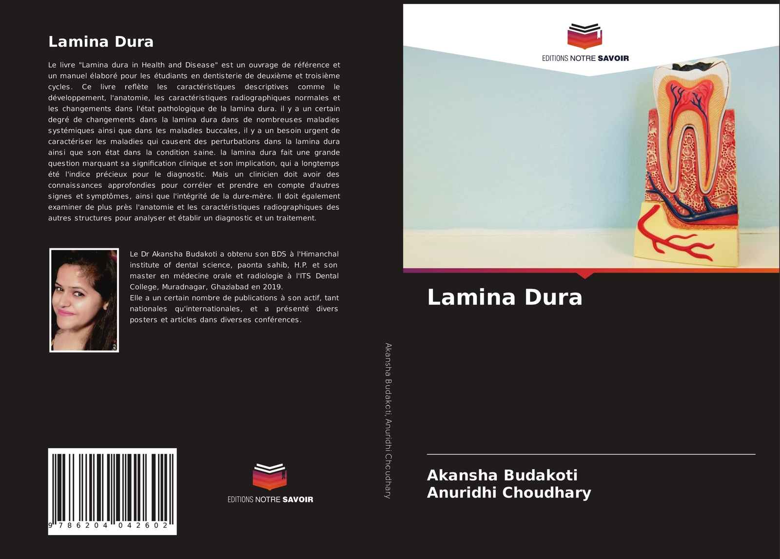 Lamina Dura Akansha Budakoti (u. A.) Taschenbuch Paperback Französisch