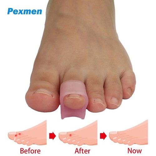Hammertoe Corrector Gel Toe Splints Straightener for Bent Curled Toes Relief - Picture 22 of 25