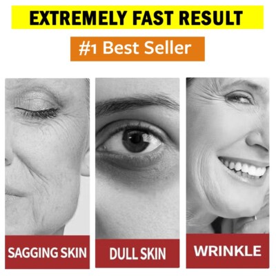 2PCS Advanced Multi-Action Firming Cream, 2025 New Professional Bee Venom