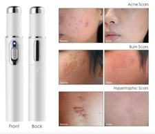 Blue Light Therapy Acne Laser Pen Treatment Quality Skin Spots Removal
