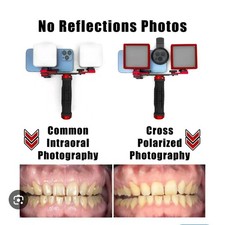 Dental Photography Mobile Phone Light for Dentist Photo no-reflective shoot MK16