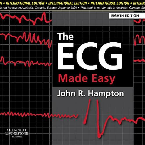 The ECG Made Easy - Bild 1 von 1