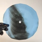 PINK FLOYD SEE EMILY PLAY X-Ray USSR Record Roentgen Bone Ribs Music Vinyl