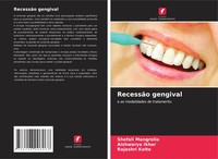 RecessãO Gengival E As Modalidades De Tratamento. Shefali Mangrolia (U. A.) Buch