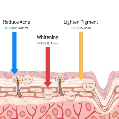 Dispositivo antienvejecimiento máscara facial de silicona terapia de rejuvenecimiento de fotones a color 3 LED - Imagen 6 de 10