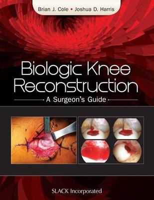 Biologic Knee Reconstruction : A Surgeon's Guide, Hardcover by Cole, Brian J....