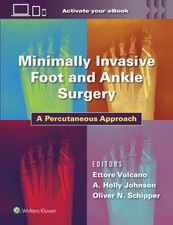 Minimally Invasive Foot and Ankle Surgery | A...
