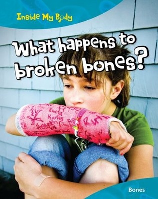 What Happens to Broken Bones? : Bones Hardcover Carol Ballard