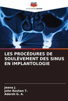 Jeena J. (U. A.) | LES ProcÉDures DE SoulÈVement DES Sinus EN Implantologie