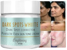 Dark spot cream corrector face acne Made in USA body age spot hands neck 4 fl oz