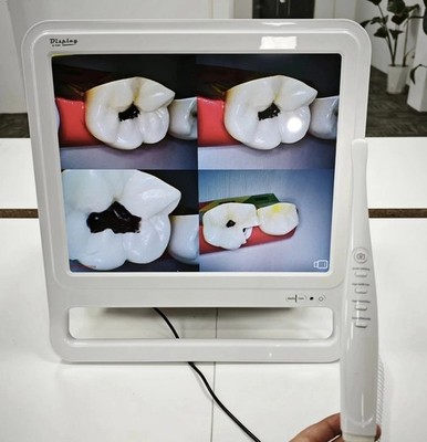 All in One Dental Endoscope System Intra Oral Camera with Monitor Wifi
