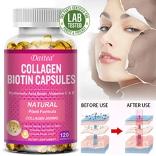 Natural Plant-based Capsules—Collagen 2000MG—support Healthy Skin, Hair and Nail