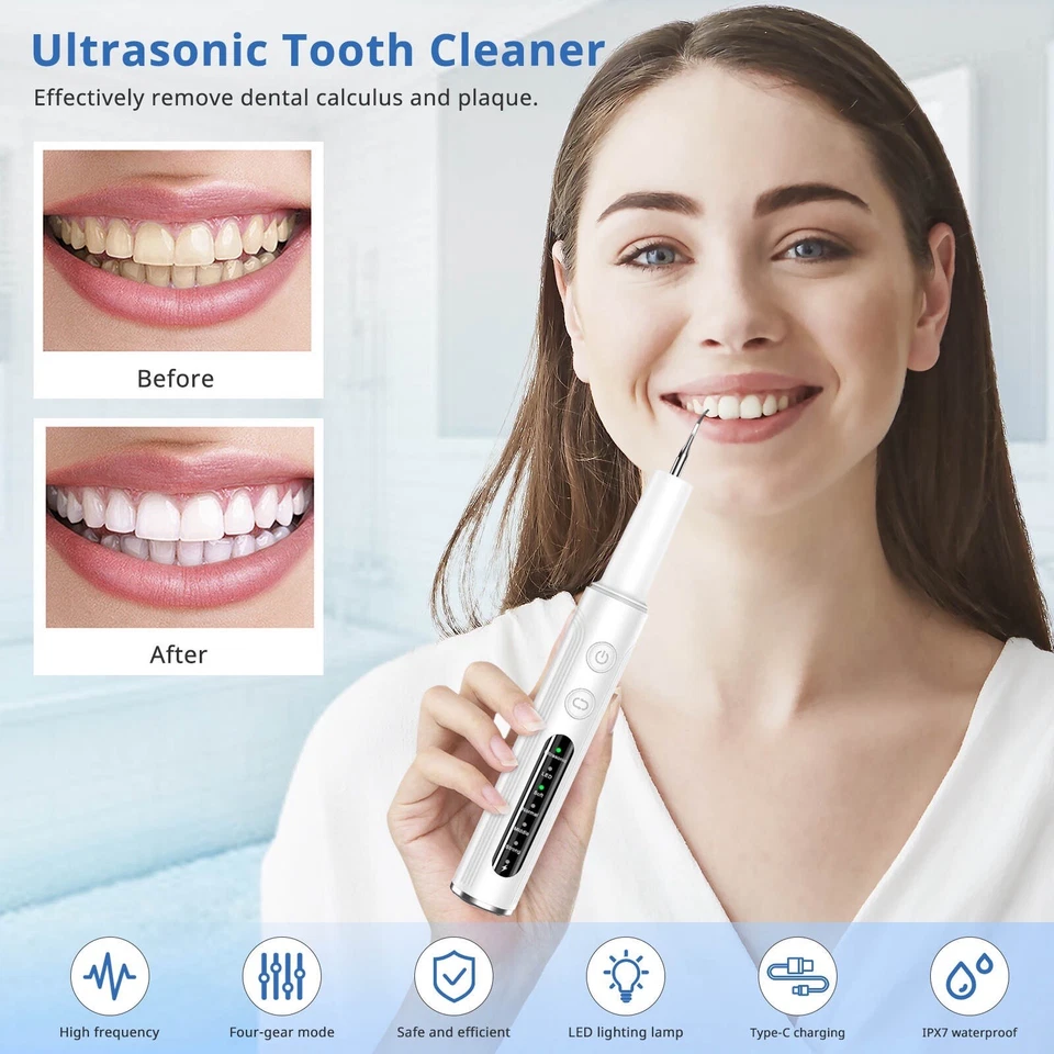 Ultrasonic Tooth Cleaner Tartar Plaque Remover Electric Dental Whiten Kit Scaler - Image 3 of 4