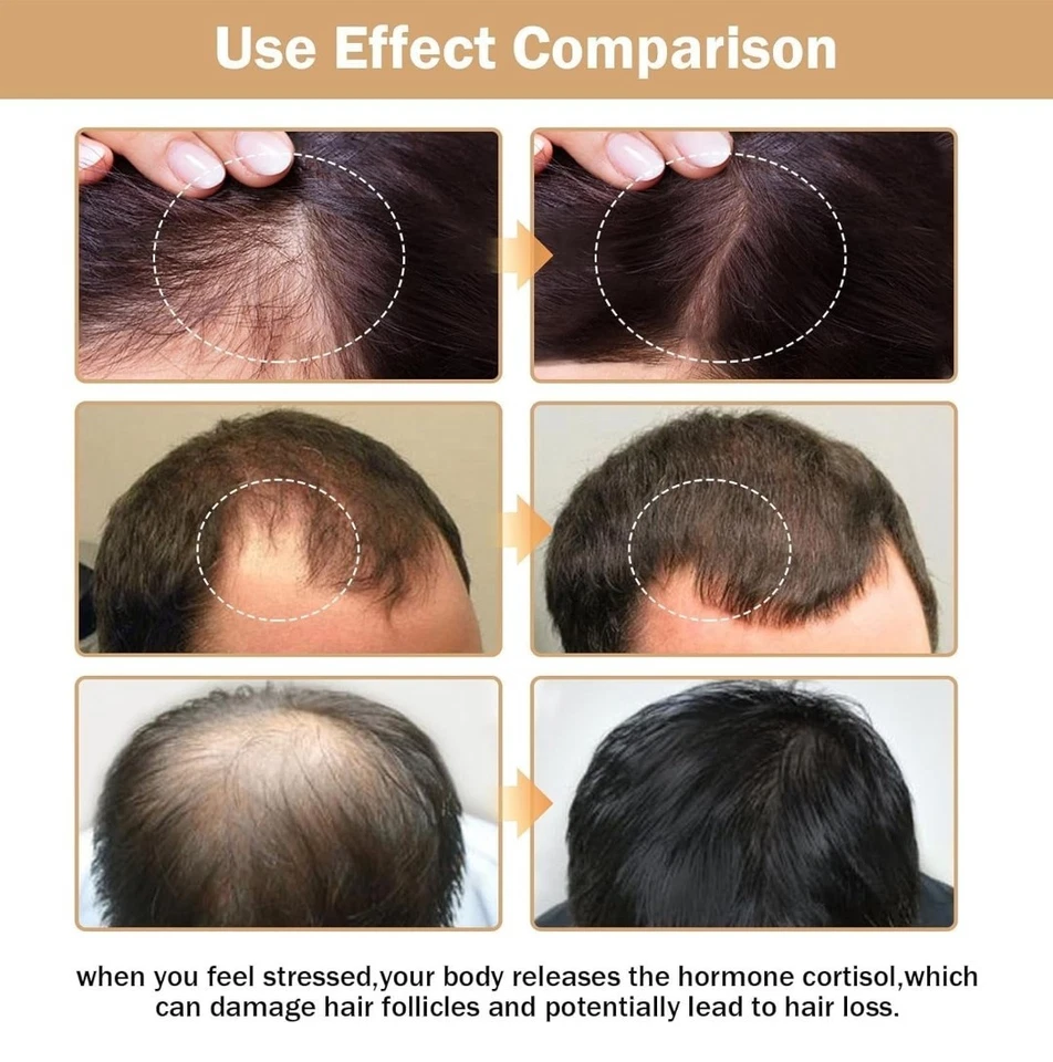 3 Pack - Root Activator Shampoo SPARTAN Hair Loss Shampoo Shampoo Root Activator - Image 4 of 4