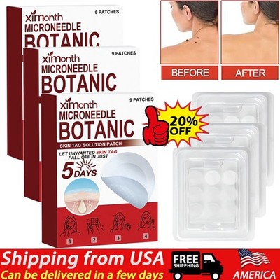 45 PCS Microneedle Botanic Skin Tag & Acne Patch Skin Tag Remover Patches HOT