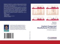 Manoj Kumar (U. A.) | Implant Supported Maxillofacial Prosthetics | Taschenbuch