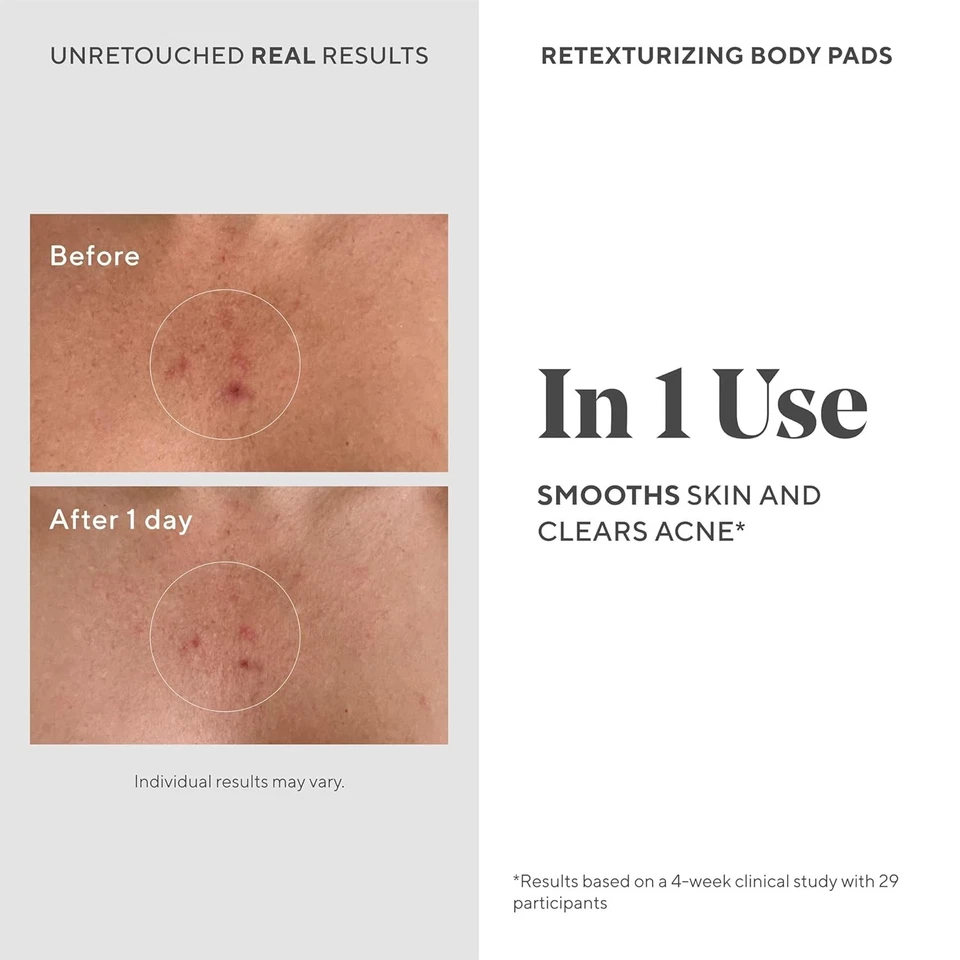 Almohadillas corporales retexturizantes Murad para control de acné 45 almohadillas NUEVO ENVÍO RÁPIDO Foto 3 de 4