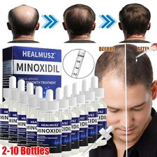 2-10 Pack Minoxidil 5 Extra Strength Men Hair Regrowth Solution 10 Month Supply