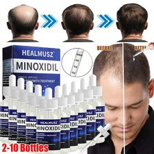 2-10 Pack Minoxidil 5% Extra Strength Men Hair Regrowth Solution 10 Month Supply