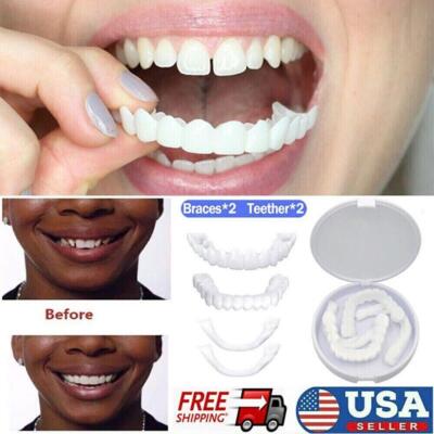 Dientes Postizos Carillas Dentales Dentadura Cubierta Dientes Inferior Superior