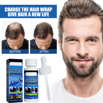 Minoxidil 5% Liquid Extra Strong for Men Beard Hair Regrowth Solution Treatment | eBay Minoxidil 5% Liquid Extra Strong for Men Beard Hair Regrowth Solution Treatment | eBay