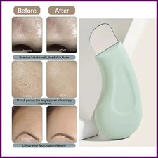 Blackhead and Whitehead Removal Tool for Nose and Face - Skin Pore Cleaner Skin