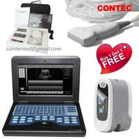 CMS600P2 Portable Ultrasound Scanner Laptop Ultrasound Machine 7.5M Linear Probe